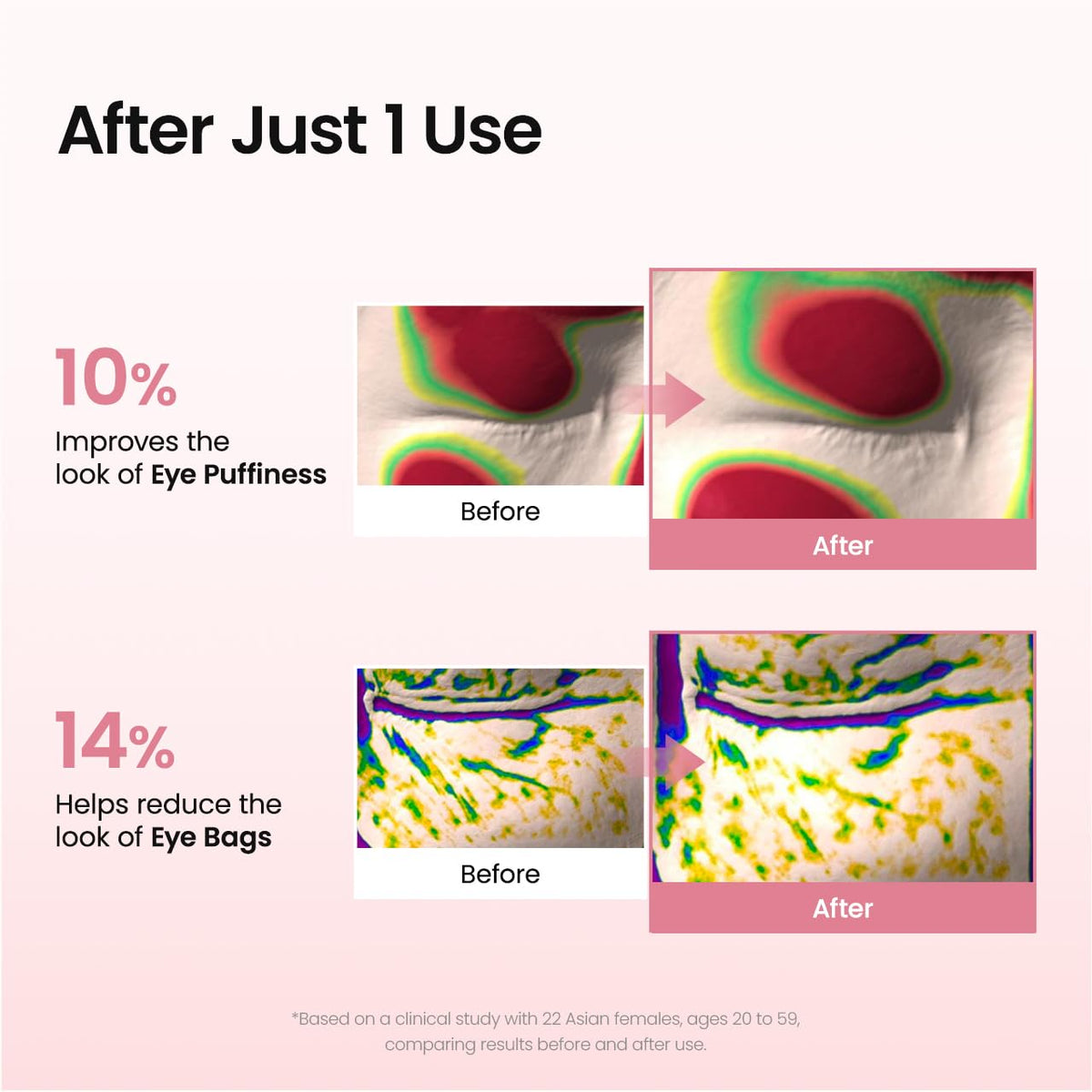 Contcove Peptide Collagen Hydrogel Eye Patches – 60 Patches